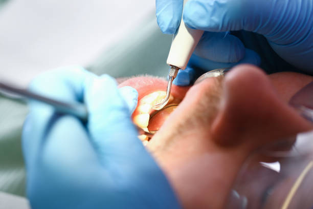 Best Emergency Root Canal Treatment in Silver Ridge, NJ