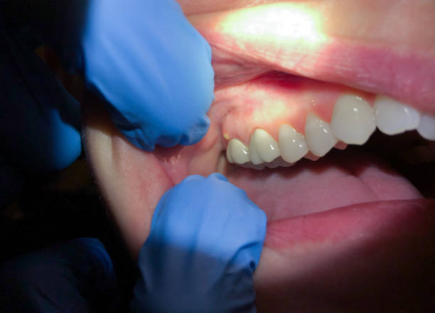 Best Pediatric Emergency Dentist in Silver Ridge, NJ