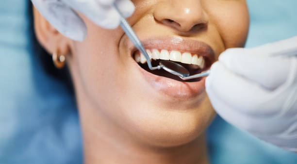 Best Emergency Broken Tooth Repair in Silver Ridge, NJ
