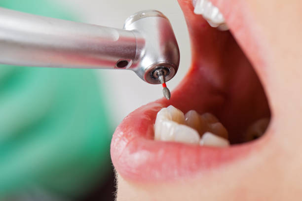 Best Emergency Treatment for Toothache in Silver Ridge, NJ